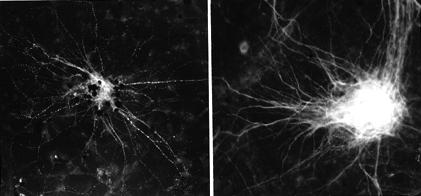 HIV (left) Healthy (right)